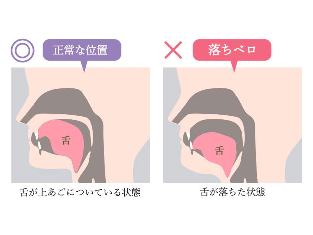 スタイリーフェイス