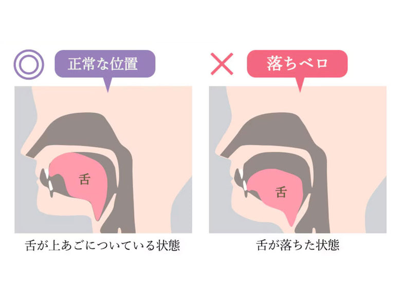 スタイリーフェイス